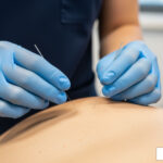 Dry needling therapy